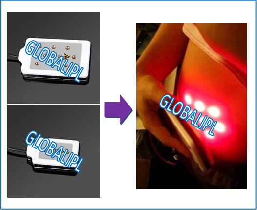 dioda mesin desktop lipolisis lemak Laser